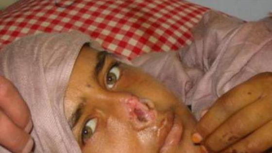 شکنجه و جنایات علیه کرامت انسانی در افغانستان 