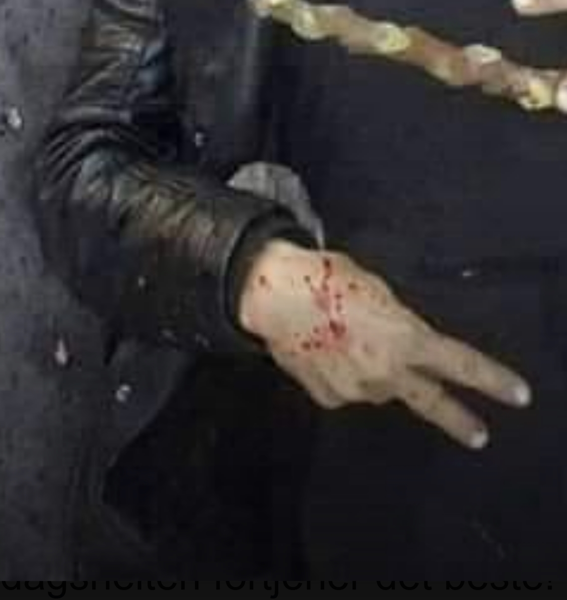 Video: Pashtun Security Forces Fire On Hazara Peaceful Protesters in Kabul