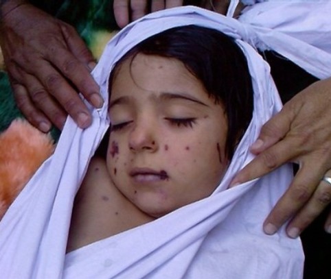 کودکان، قربانيان جنگ! 